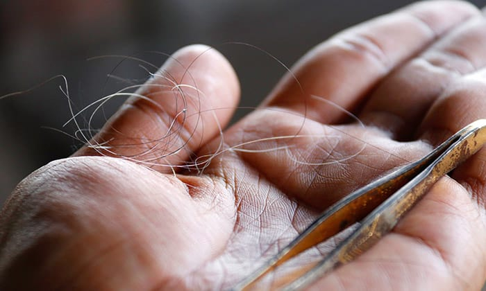 ไม่อยาก ผมหงอก จนรู้สึก แก่ก่อนวัย ลองเลือกกินและเลี่ยงอาหารเหล่านี้สิ!