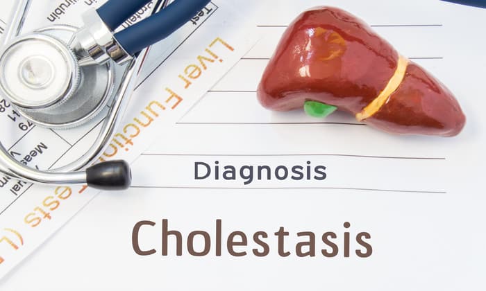 คอเลสเตซิส (Cholestasis)