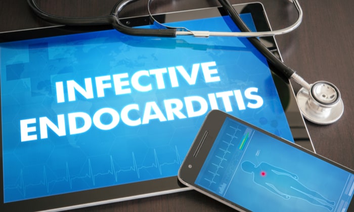 เยื่อบุหัวใจติดเชื้อ (Infective Endocarditis)