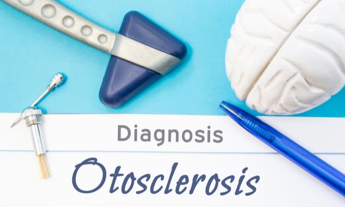 โรคหินปูนเกาะกระดูกหู (Otosclerosis)