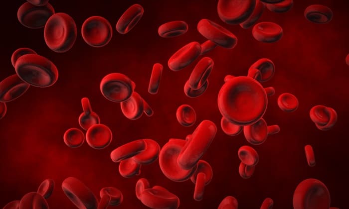 กาฬโรคแบบโลหิตเป็นพิษ (Septicemic Plague)