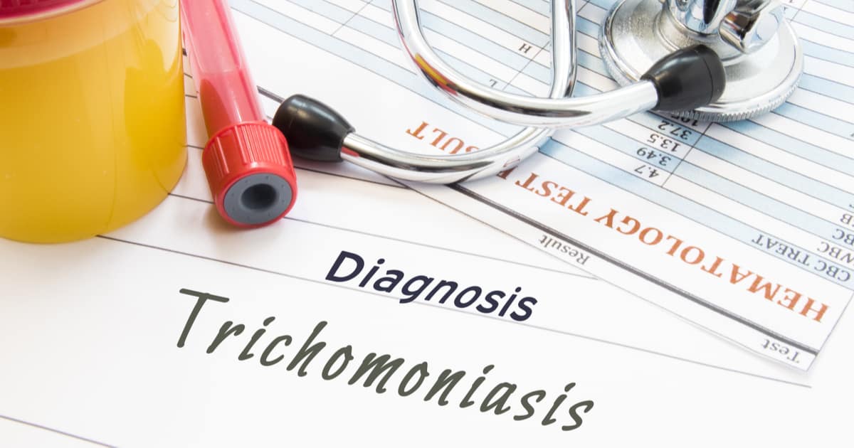 พยาธิในช่องคลอด (Trichomoniasis)
