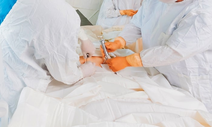 ปลูกถ่ายไขกระดูก (Bone Marrow Transplantation) หรือ ปลูกถ่ายเซลล์ต้นกำเนิด