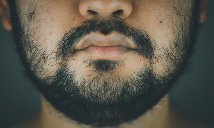 อาการคันเครา อาการที่เกิดขึ้นเมื่อผู้ชายไว้เครา