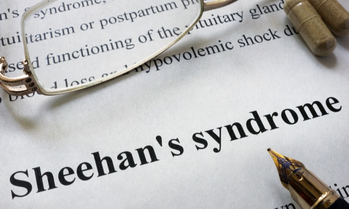 โรคชีแฮน ภาวะตกเลือดมากขณะคลอดหรือหลังคลอด