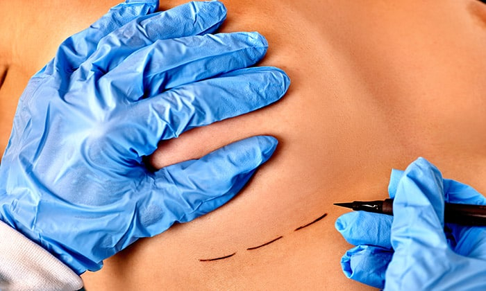 เต้านมอักเสบ สัญญาณเตือนที่อาจนำไปสู่ ฝีเต้านม