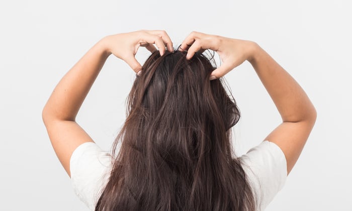 แพ้แชมพูสระผม อันตรายจากการสระผมที่ควรต้องระวัง