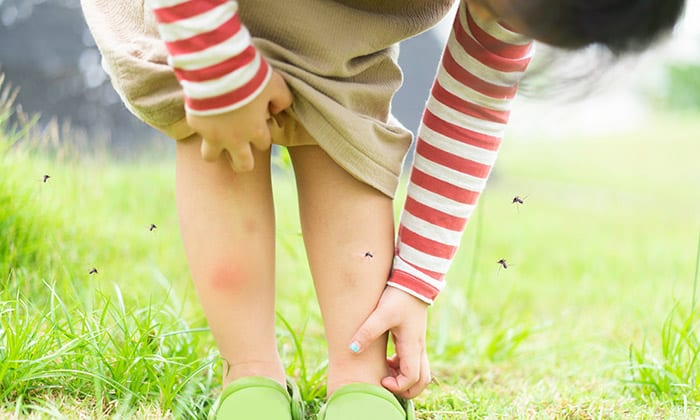 แมลงสัตว์กัดต่อย (Insect Bites)