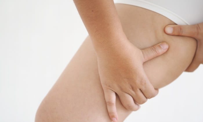 ขาใหญ่ น่องโต เพราะไขมันเยอะ จะแก้อย่างไรดี