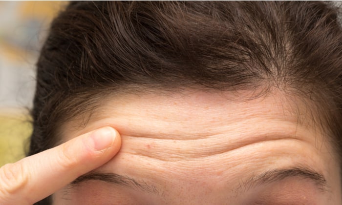 หน้าผากย่น อาจมาจากพฤติกรรมเสี่ยงที่ทำเป็นประจำ