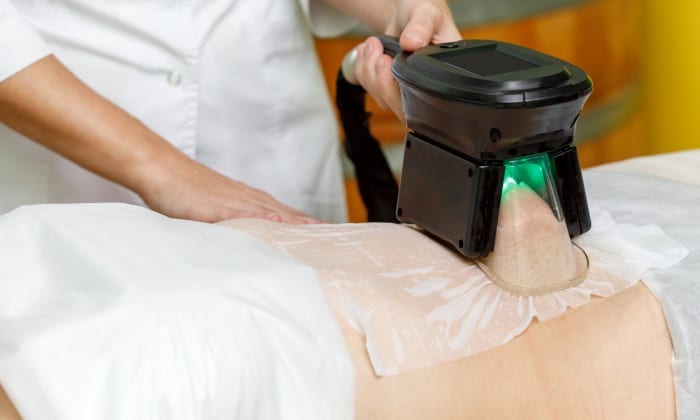 สลายไขมันด้วยความเย็น อีกหนึ่งทางเลือกของคนอยากผอม