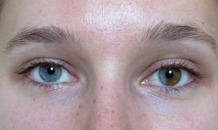 ภาวะตาสองสี ลักษณะทางพันธุกรรมซับซ้อน ที่อาจค้นพบได้ในมนุษย์