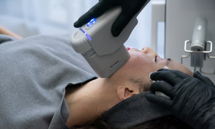 ไฮฟู เครื่องยกกระชับใบหน้า ที่อาจช่วยชะลอการหย่อนคล้อยของผิว