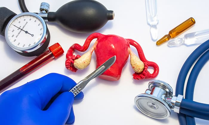 ผลข้างเคียงหลังผ่าตัดมดลูก ที่คุณควรรู้ ก่อนตัดสินใจรักษาโรคด้วยวิธีนี้