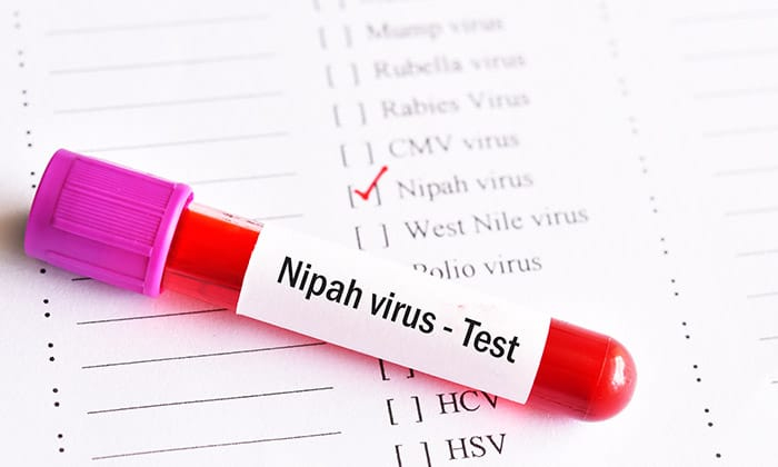 โรคติดเชื้อไวรัสนิปาห์ โรคจากไวรัสมรณะ ที่ยังไร้วัคซีนรักษา