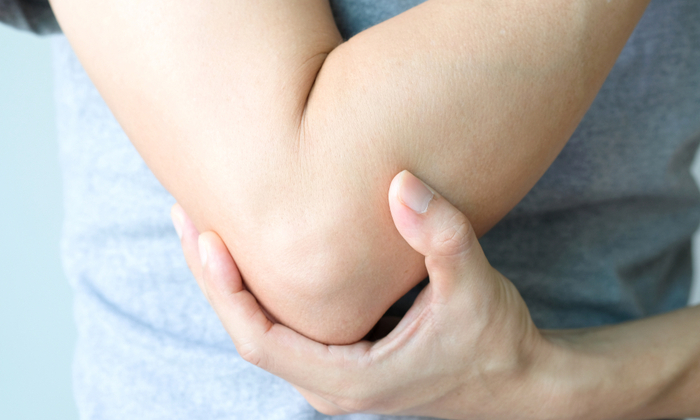 โรคสะเก็ดเงินบริเวณซอกพับ สาเหตุ และการบรรเทาอาการ