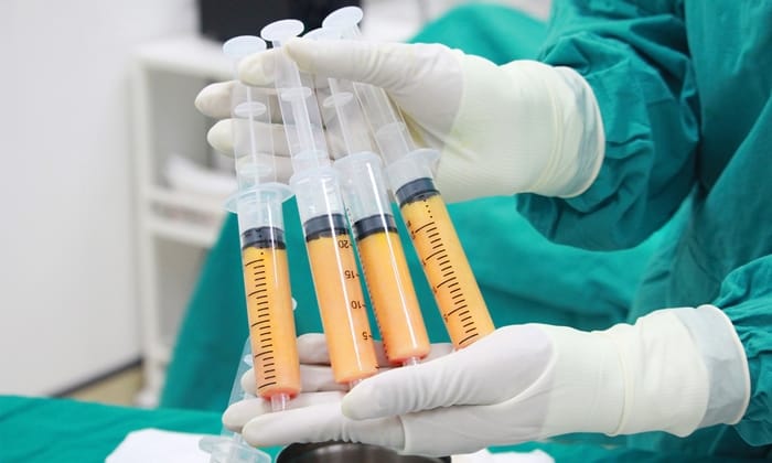 เสริมหน้าอกด้วยการฉีดไขมัน กับข้อดีและข้อเสียที่ผู้หญิงควรรู้