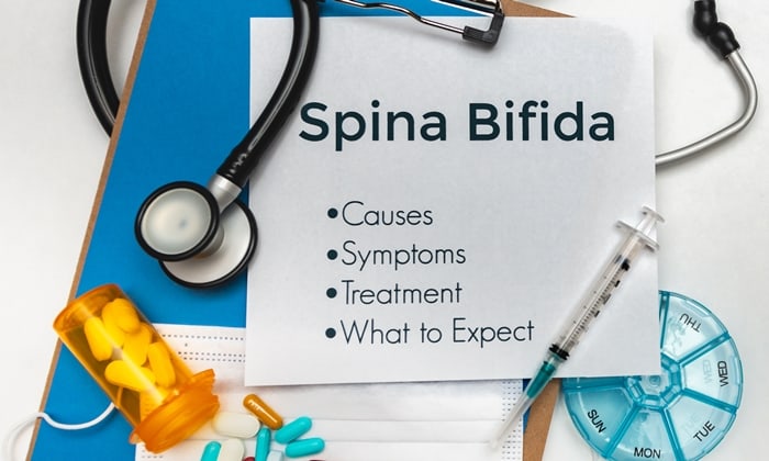 ความบกพร่องของกระดูกไขสันหลัง (Spina Bifida)
