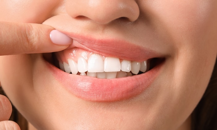 เรื่องที่คุณควรรู้ ก่อนการ ศัลยกรรมตกแต่งเหงือก เพื่อเพิ่มความยาวฟัน