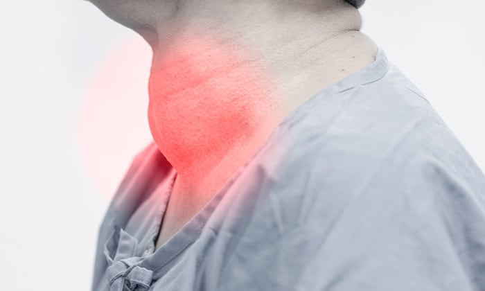 คอพอก สาเหตุ อาการ และการรักษา