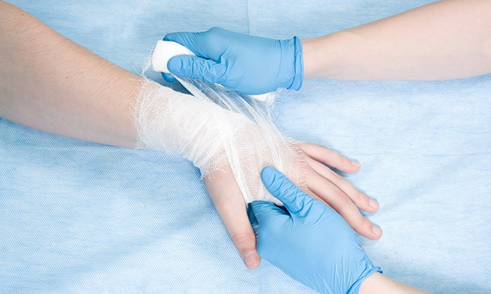 แผลฉีกขาดที่ผิวหนัง ควรดูแลรักษาอย่างไร