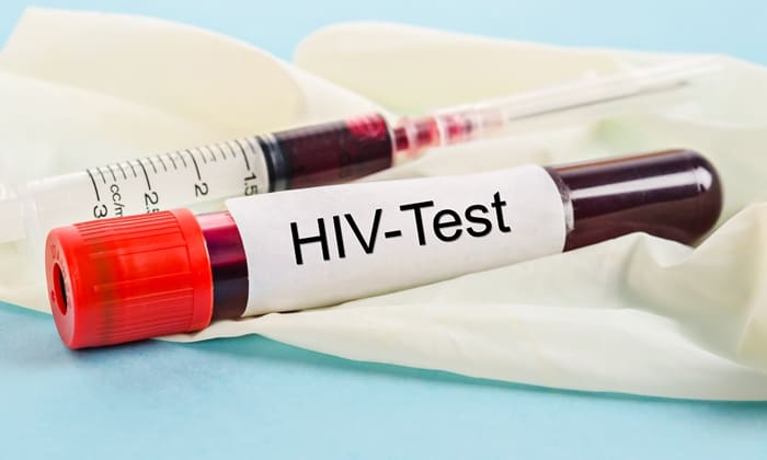ขั้นตอนการตรวจเชื้อ HIV ต้องทำอย่างไรบ้าง