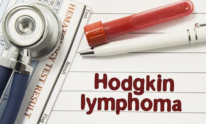 มะเร็งต่อมน้ำเหลืองฮอดจ์กิน (Hodgkin's Lymphoma)