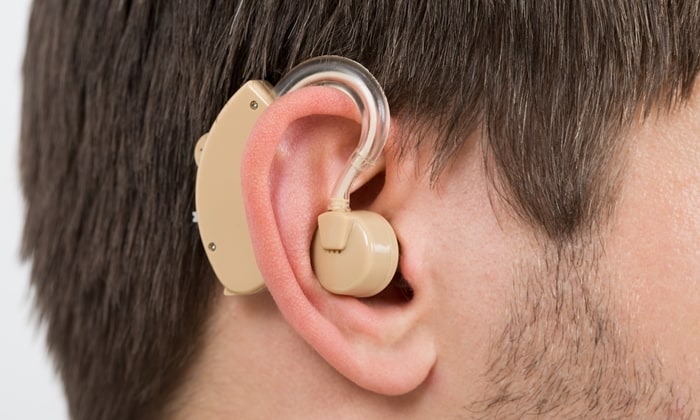 โรควาร์เดนเบิร์ก ภาวะพันธุกรรมหายาก ที่อาจทำให้สูญเสียการได้ยิน