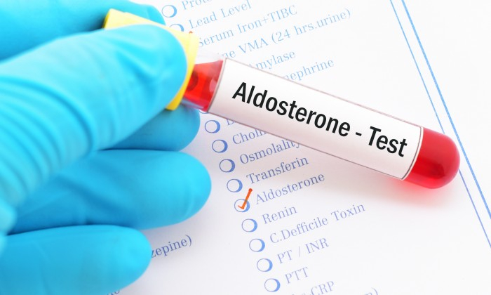 การตรวจแอลโดสเตอโรน ฮอร์โมนที่มีส่วนช่วยในการควบคุมความดันโลหิตสูง