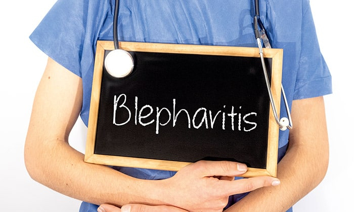 เช็ดเครื่องสำอางไม่สะอาด เปลือกตาสกปรก ปัญหาเหล่านี้อาจทำให้ เปลือกตาอักเสบ ได้