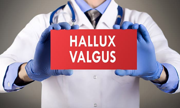 ภาวะนิ้วหัวแม่เท้าเอียง (Hallux Valgus)