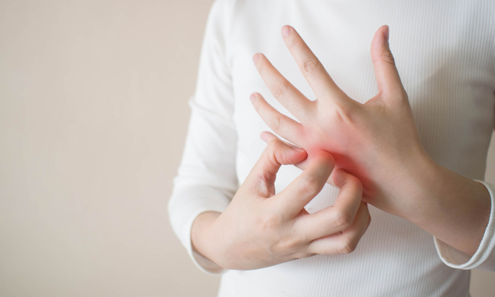 หนังแข็ง (Scleroderma) อาการ สาเหตุ และการรักษา