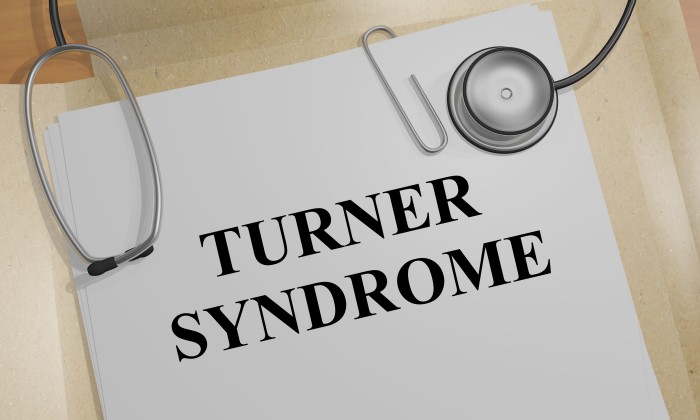 กลุ่มอาการเทอร์เนอร์ (Turner Syndrome)