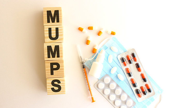 คางทูม (Mumps) อาการ สาเหตุ การรักษา