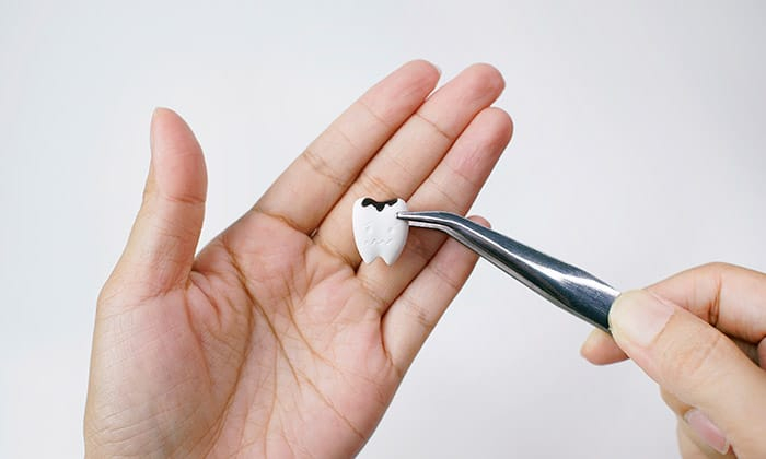 ปวดฟันเมื่อกินของหวาน เป็นแบบนี้ทุกที ทำอย่างไรดีนะ