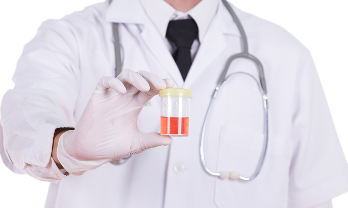 รู้หรือไม่ อาการปัสสาวะเป็นเลือด เกิดจากสาเหตุอะไรกันแน่