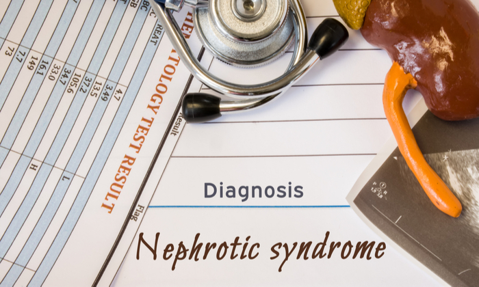 เนโฟรติก ซินโดรม (Nephrotic Syndrome)