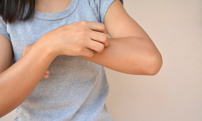 ตุ่มน้ำพอง อาการ สาเหตุ การรักษา