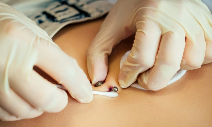 ร่างกายปฏิเสธการเจาะ อีกเรื่องที่ควรรู้ก่อนเจาะร่างกาย