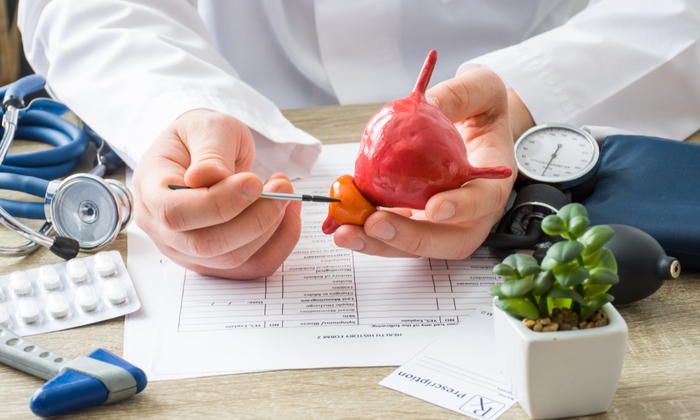 การทดสอบ PCA3 เทคนิคการตรวจหามะเร็งต่อมลูกหมากที่ควรรู้