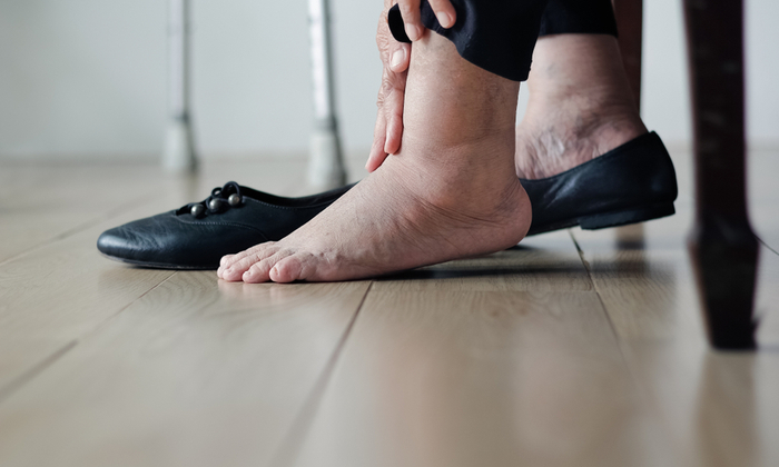 โรคเบาหวาน ผลกระทบ ที่เกิดขึ้น และการป้องกันโรคเบาหวาน