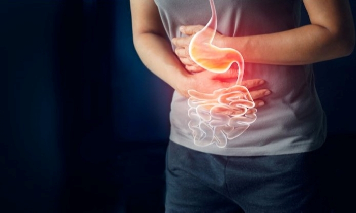 ถุงผนังลำไส้อักเสบ ปัญหาระบบทางเดินอาหาร ที่ควรเร่งรักษา