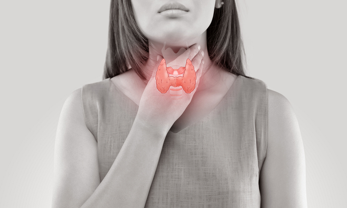 ไฮโปไทรอยด์ (Hypothyroidism)