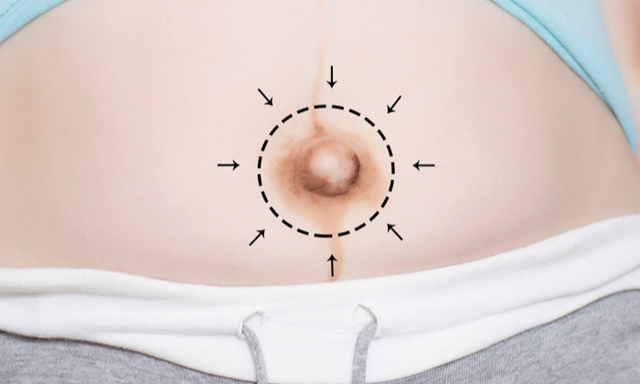 สะดือคนท้อง ระหว่างตั้งครรภ์ เปลี่ยนแปลงอย่างไรบ้าง