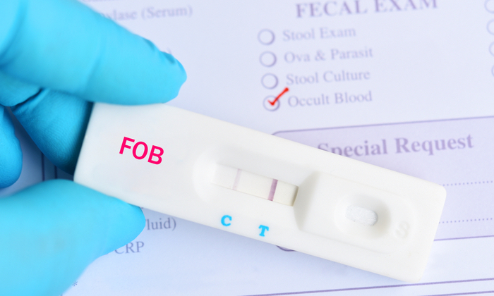 การตรวจคัดกรองมะเร็งลำไส้ใหญ่ อีกหนึ่งวิธีช่วยลดอัตราการเสียชีวิตจาก โรคมะเร็งลำไส้