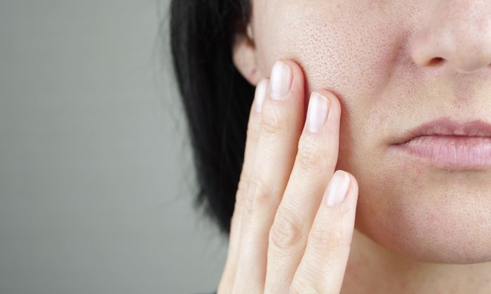 ผิวหน้าหยาบกร้าน แห้งเป็นขุย สาเหตุ และวิธีรักษา