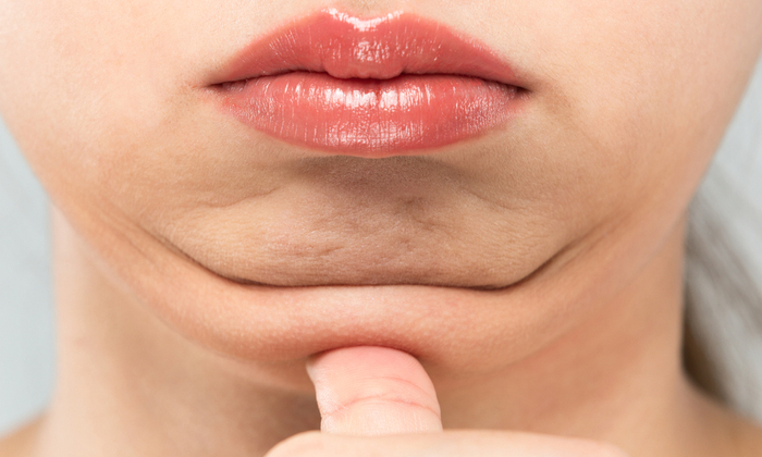 ลดเหนียงใต้คาง กำจัดคางสองชั้น ทำได้อย่างไรบ้าง