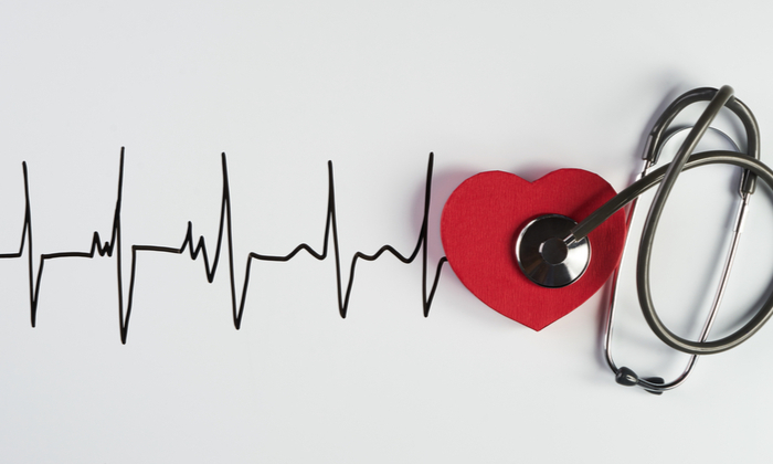 หัวใจเต้นแรง สัญญาณเตือนของ ภาวะหัวใจเต้นผิดจังหวะ