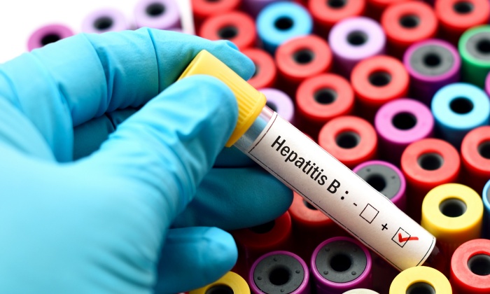 การตรวจไวรัสตับอักเสบบี อีกวิธีลดความเสี่ยงมะเร็งตับ พร้อมค่าตรวจเริ่มต้นที่คุณควรรู้
