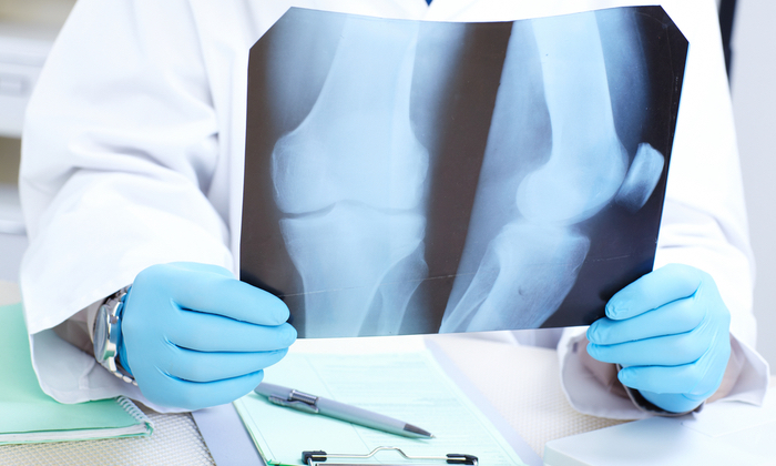 ทำความรู้จัก ประเภทของมะเร็งกระดูก มีชนิดใดบ้างนะ